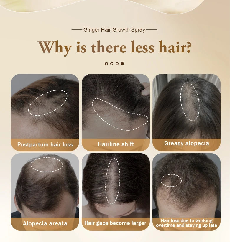 PURC Ginger Hair Growth Products for Men and Women