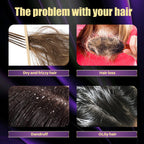 Hair Shampoo For Fast Hair Growth