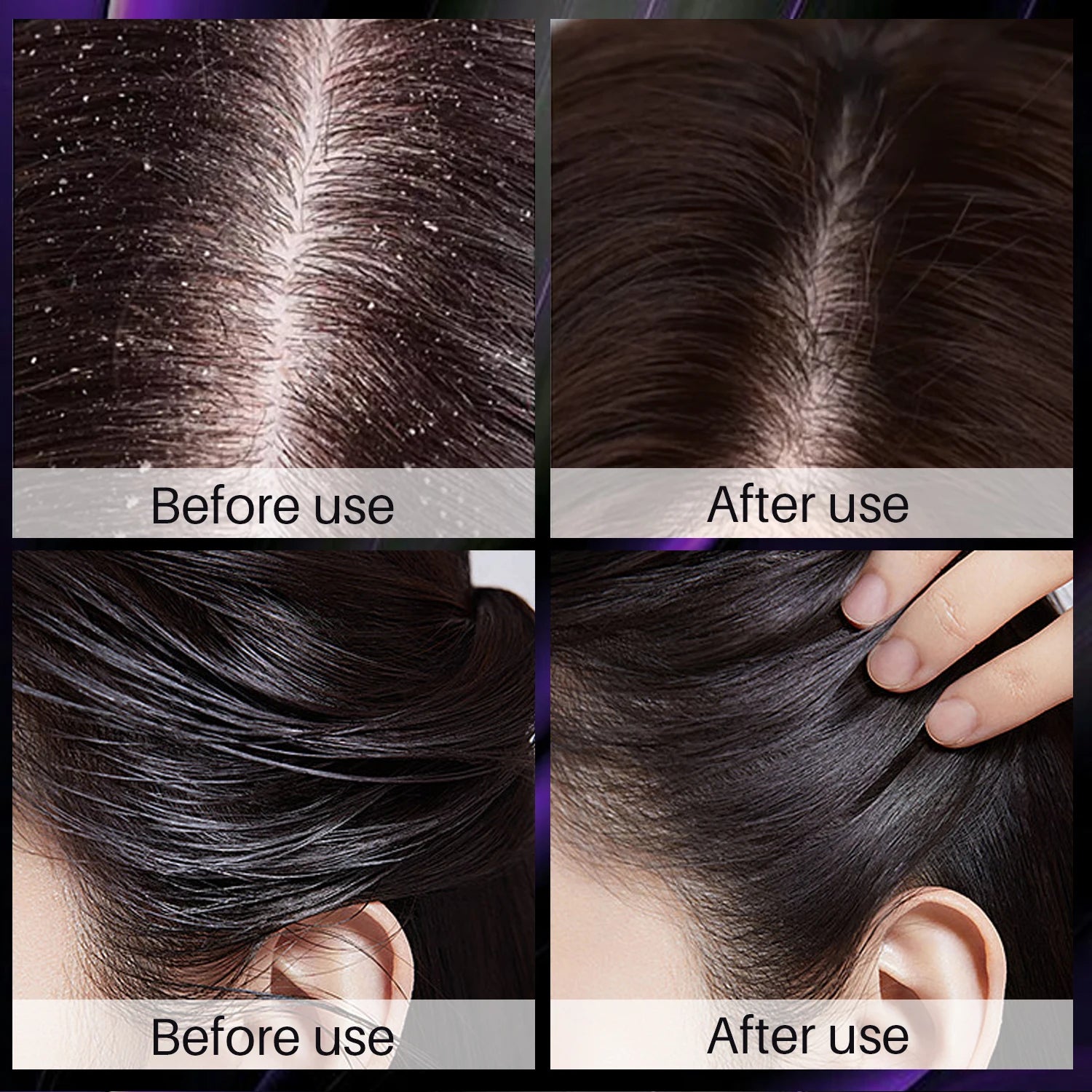 Hair Shampoo For Fast Hair Growth